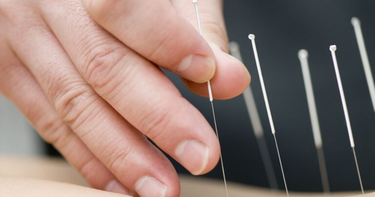 California Acupuncture Regulations